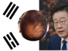 South Korea’s President Pushes for Public Health Coverage of Hair Loss Treatment